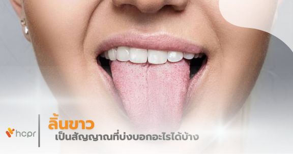 ลิ้นขาว เป็นสัญญาณที่บ่งบอกอะไรได้บ้าง