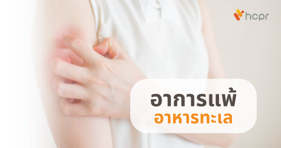 อาการแพ้อาหารทะเล