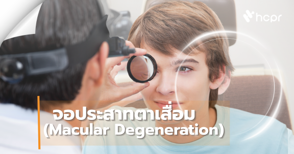 จอประสาทตาเสื่อม (Macular Degeneration)