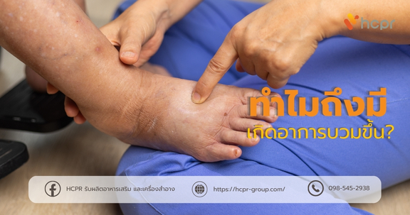 ทำไมถึงบวม?